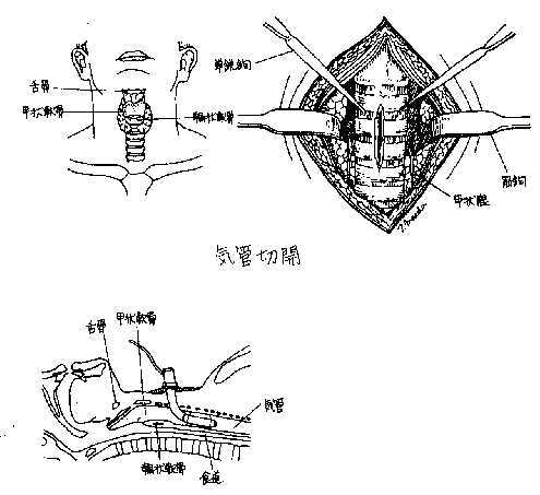 figure1503